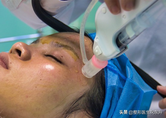 打水光针要知道的问题,说打水光针害怕针眼怎么回答
