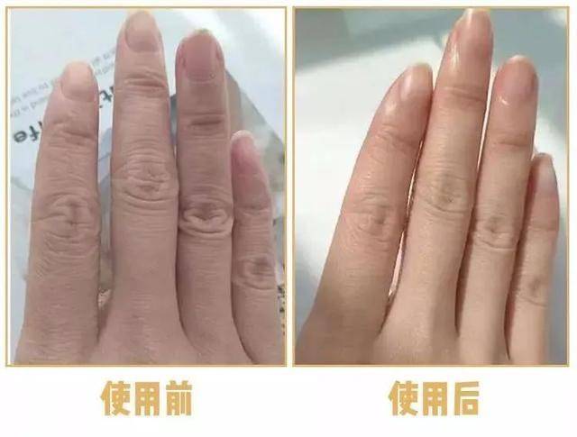 珂润跟片仔癀哪个好,片仔癀和珂润哪个好用