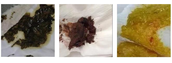 如何判断奶粉喝了好不好,吐奶怎么确定是否奶粉过敏