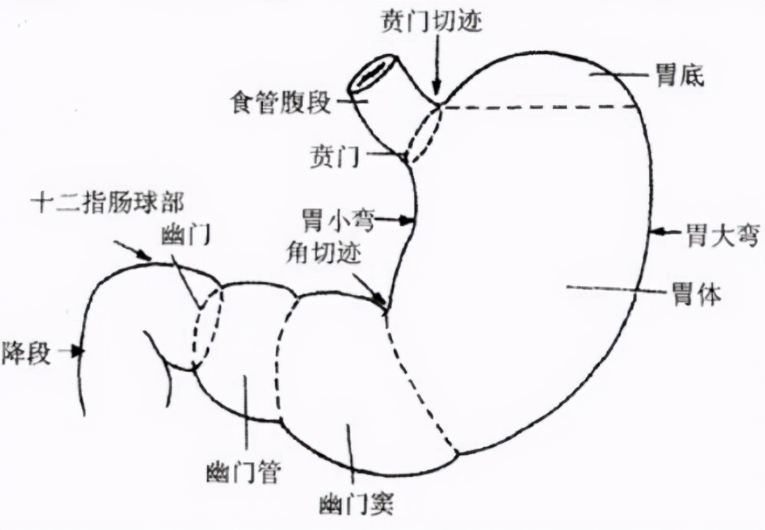 胃癌胃病,胃病与胃癌区分