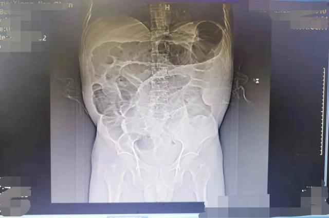 不忘初心，爱撒漾濞，我科支边医生在云南
