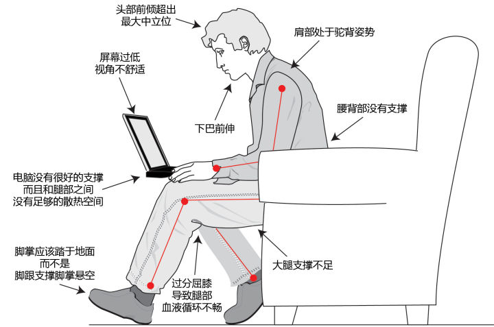 久坐会导致骨盆前倾还是骨盆后倾,开车久坐会导致骨盆前倾怎么纠正