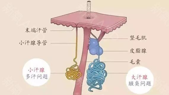 隐形狐臭患者怎么护理皮肤,狐臭治不好吗