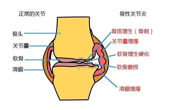 倒着走对膝盖有没有好处,倒着下楼梯对身体有好处吗
