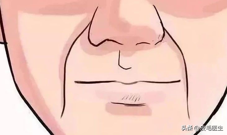 笑出法令纹！还能肆无忌惮地笑吗？正常笑！但改掉这5个习惯