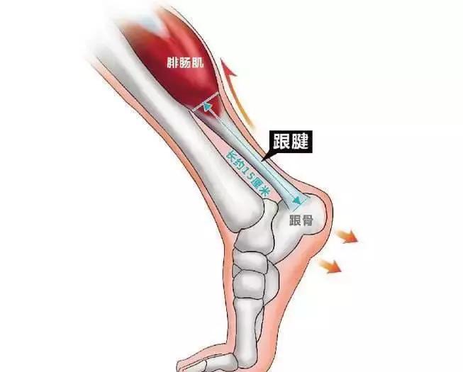 跟腱断裂原因分析,跟腱断裂发病机制