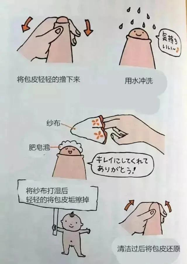 割包皮能当天做当天走吗,割包皮当天去医院当天就能割吗