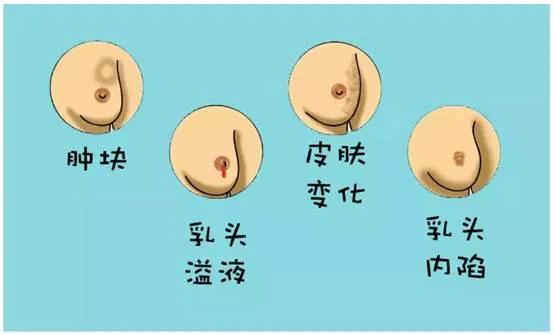 第一次去妇科检查需求注意什么,第一次产检妇科检查都有哪些项目