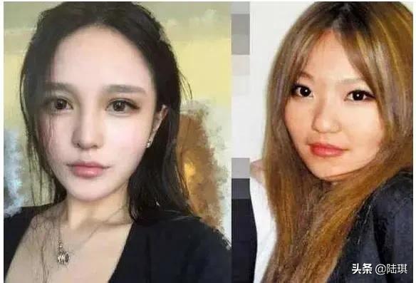 男朋友嫌弃自己丑该整容吗,男朋友嫌自己长得丑和我分手了