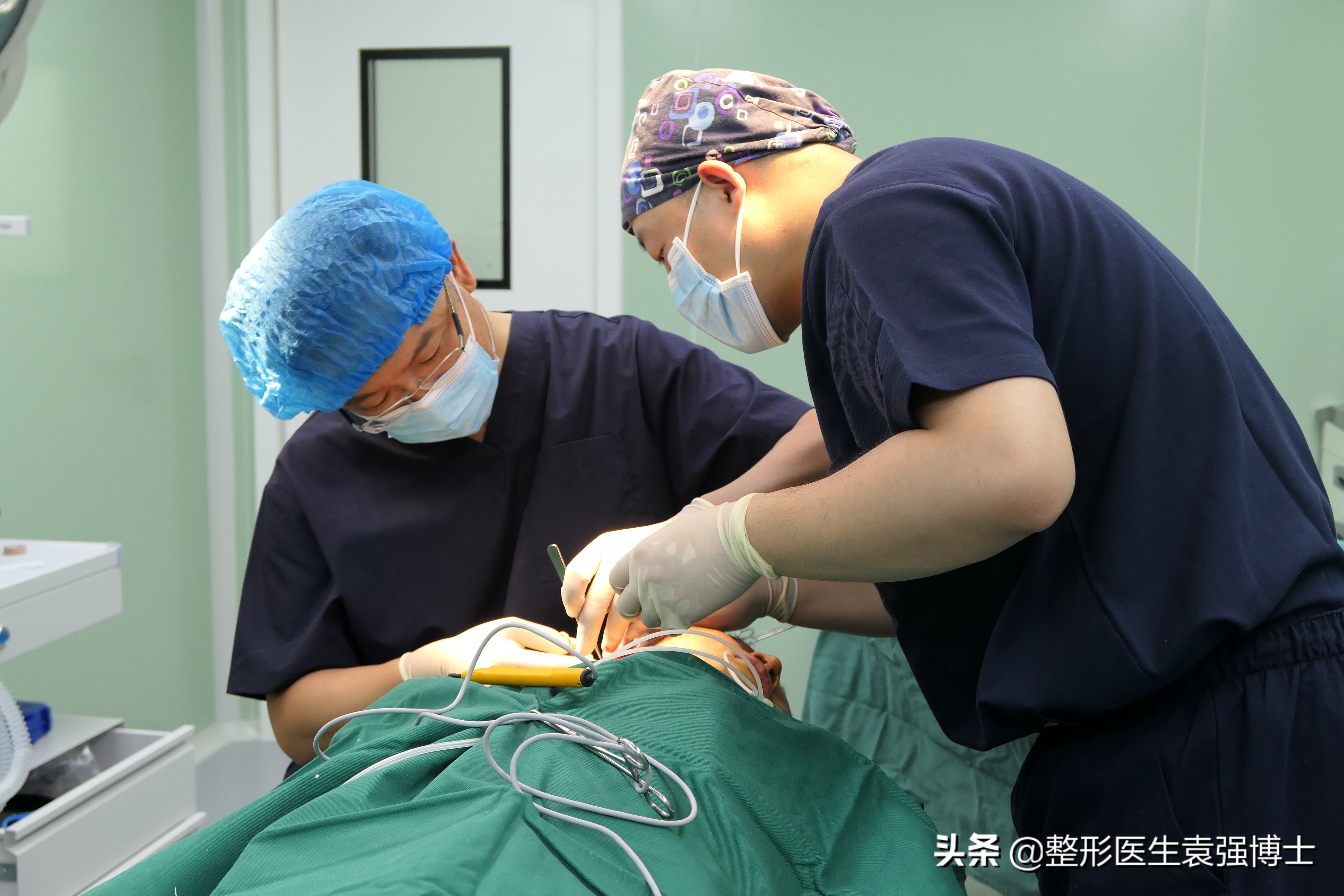 30岁小拉皮手术后7天照片,30岁拉皮恢复过程图片
