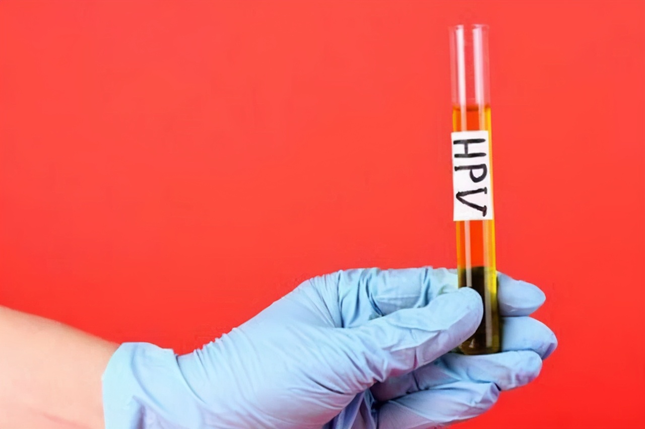 hpv16一直没转阴会怎样,hpv16转阴的小技巧很简单也很有用