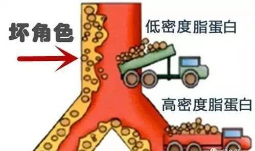 血脂高要服用药物吗,血脂高就要吃降脂药吗