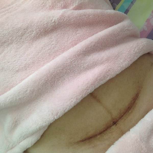为何越来越多孕妈宁愿挨刀，也不愿选择顺产？原因不外乎这3点