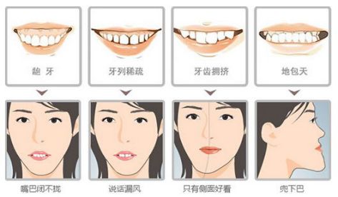 三岁孩子矫正牙齿后又反复,孩子牙齿矫正一个月看不到效果
