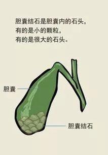 鐑偣鍖昏瑙ｈ,鐑偣鍖荤枟