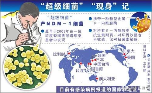 阿莫西林是抗生素类药品吗,阿莫西林消炎药用法