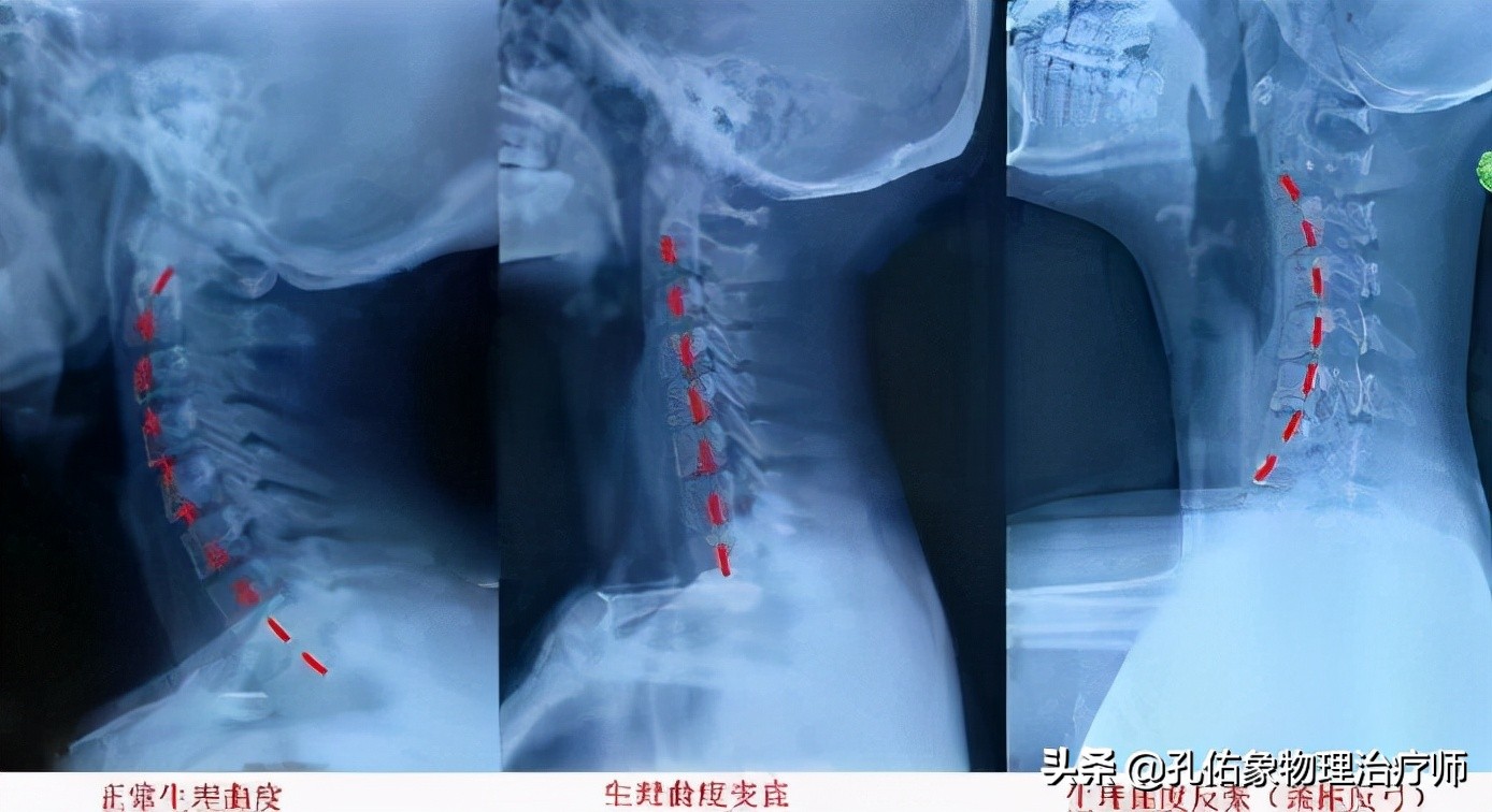 老年人肩周疼痛的厉害怎么治疗,老年人肩背部疼痛怎么回事