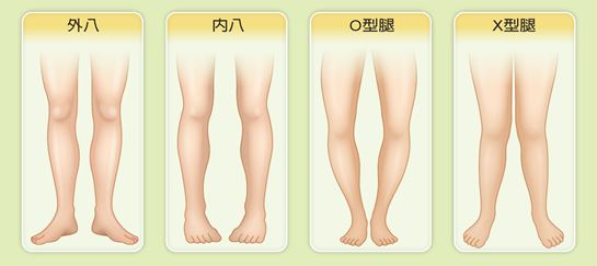 孩子抖腿的坏习惯如何纠正,儿童长短腿最佳矫正方法