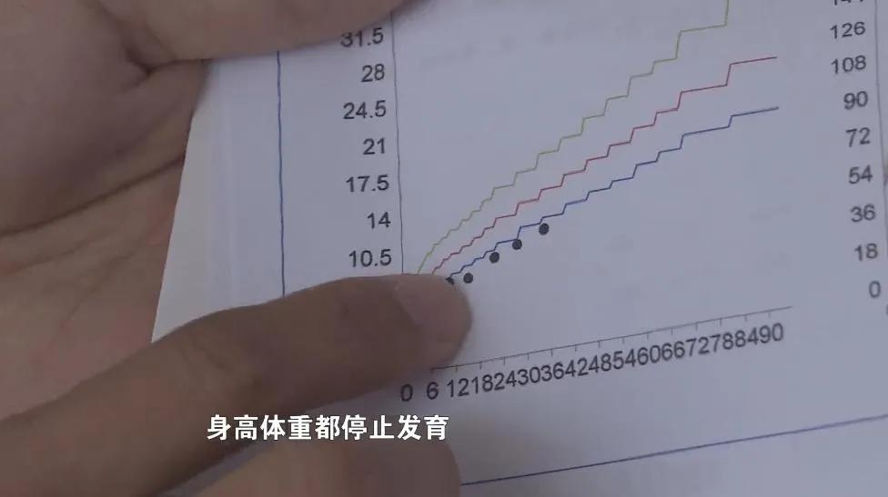 假奶粉喝成大头娃娃事件,假奶粉从包装上能识别出来吗