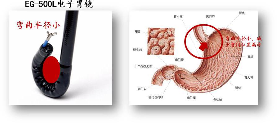 国内彩超代表企业对医疗设备的影响——开立医疗（仁成医疗维修）