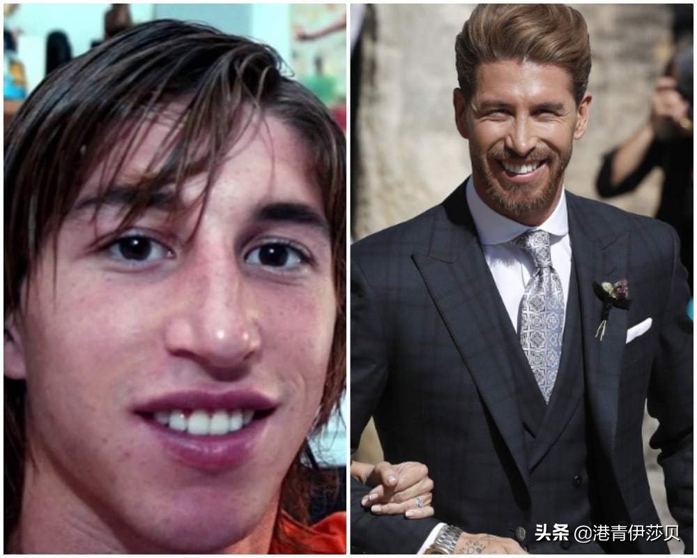 丑小鸭逆袭？带你看看这些名人们又丑又挫的小时候