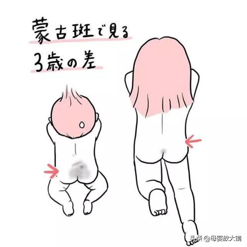 新生儿宝宝如何护理常识,宝宝常见疾病预防及日常护理
