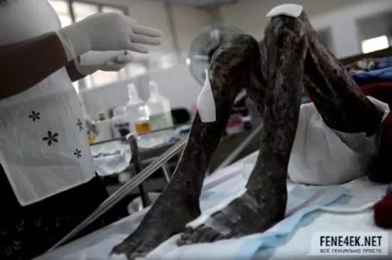 这里租妻合法,艾滋指数全球第一,每年竟还有3000万人要去