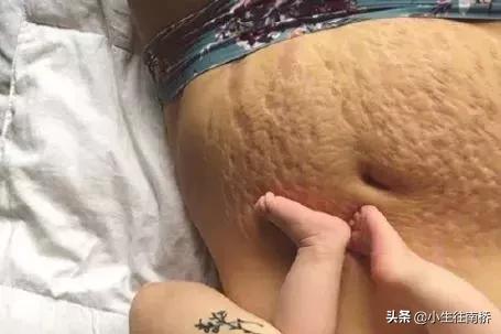 38岁天后自曝产后尿*禁失**：女人拿命生孩子，图什么？！