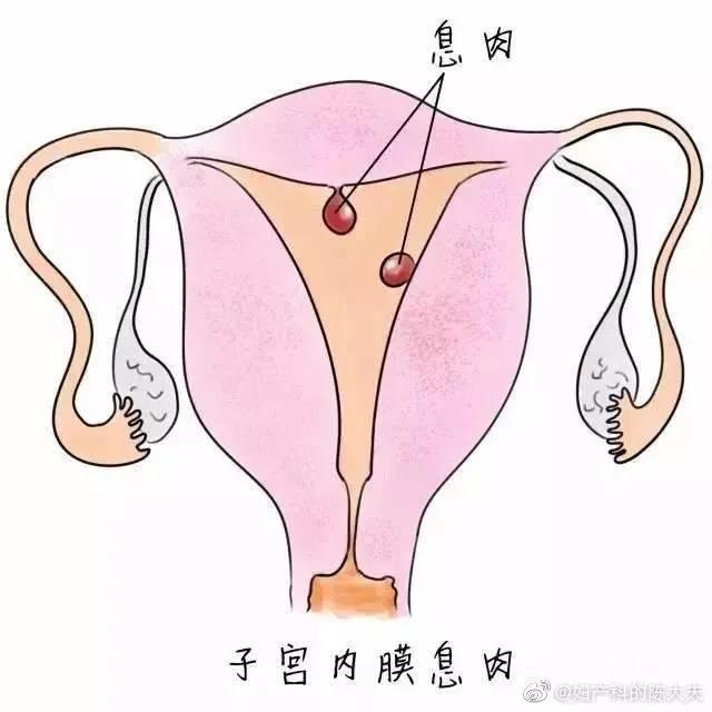 有什么合理的理由可以选择剖腹产,选择剖腹产会经历什么