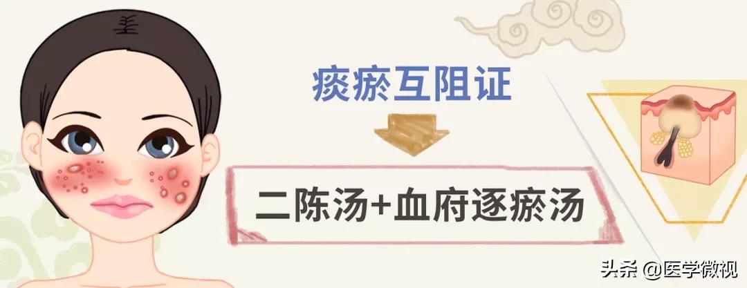 满脸痘痘怎么治不花钱,满脸痘痘中药调理效果如何