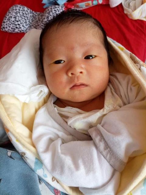 新生儿黄疸需求停母乳吃药吗,新生儿黄疸需求吃益生菌吗