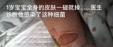 閬垮厤鑳庡効鑴愬甫缁曢娉ㄦ剰鍥涚偣,閬垮厤鑴愬甫缁曢杩欏嚑浠朵簨鍗冧竾鍒仛