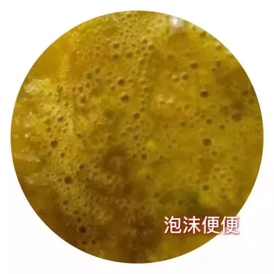 小朋友受寒感冒怎么办最快最有效,孩子刚感冒时怎么避免加重