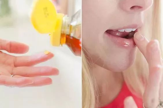 冬天怎样防嘴唇开裂,冬天嘴唇很干燥而且还开裂怎么办