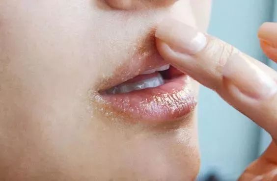 冬天怎样防嘴唇开裂,冬天嘴唇很干燥而且还开裂怎么办