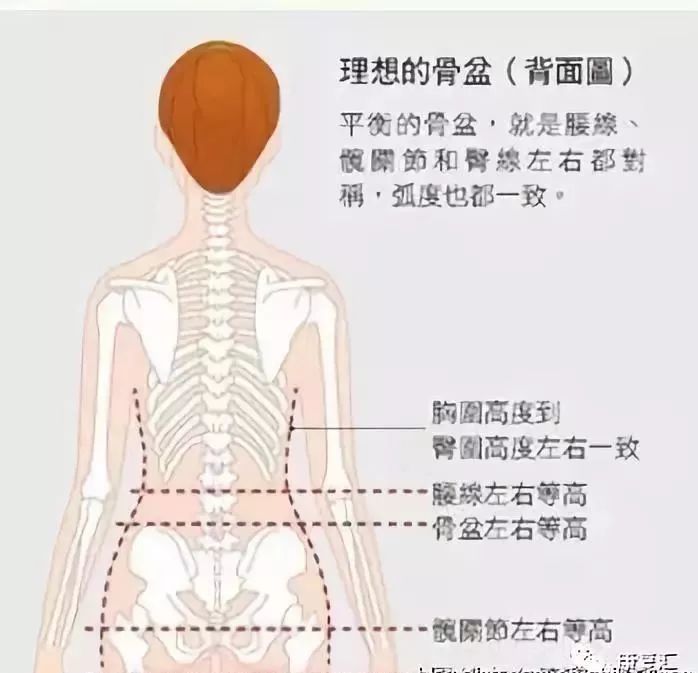 骨盆倾斜能做骨盆修复吗,体态康复骨盆前移
