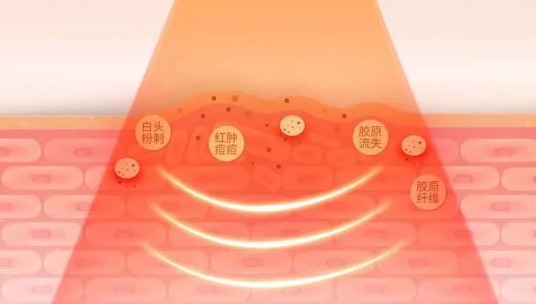 美容院的美容仪器需求投资多少钱,美容院哪些项目值得做仪器