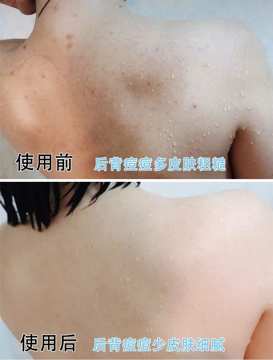 搓背不求人沐浴刷,搓背不求人的搓澡刷