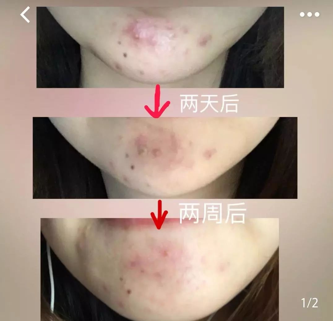 美白精华让你整个夏天都白得发光,美白精华猛料推荐