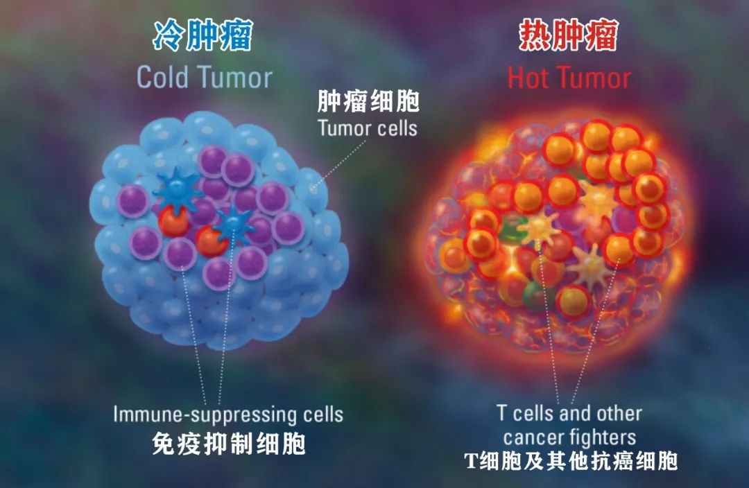 如何把冷肿瘤变成热肿瘤,肿瘤热疗新趋势热死肿瘤不伤身