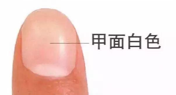 科普|指甲的状态反映了你身体的状态