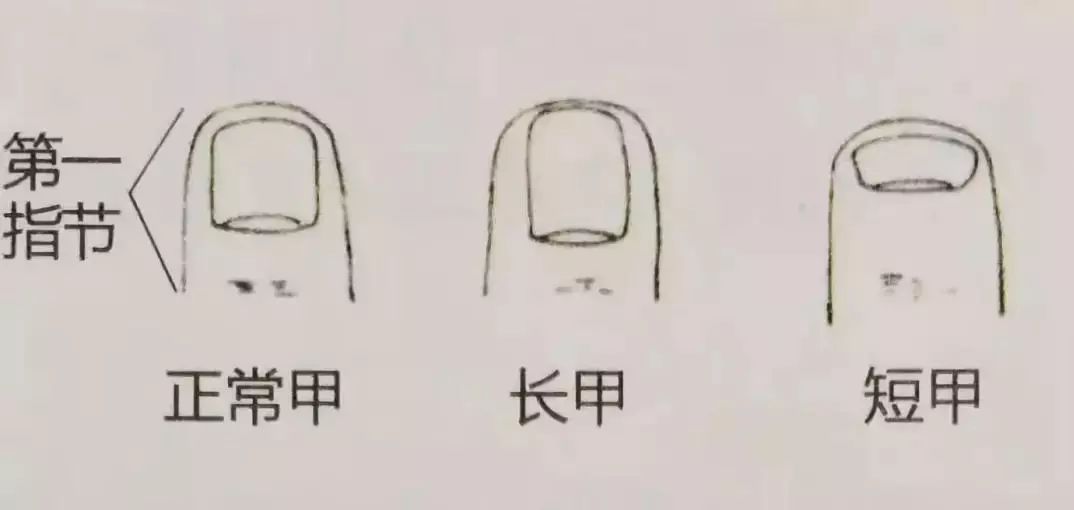 科普|指甲的状态反映了你身体的状态