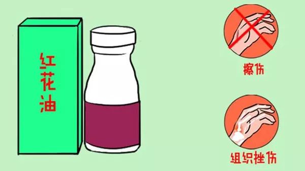 紫药水、红药水、酒精、碘伏…哪种处理伤口好？你可能一直都用错了
