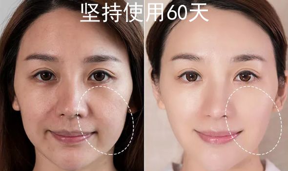 瘦脸小v脸的方法,每天张嘴闭嘴100下能瘦脸吗