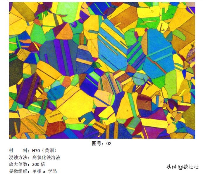 马氏体和奥氏体金相图片,马氏体和珠光体金相区分