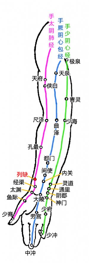 颈项痛的病因,左颈项痛