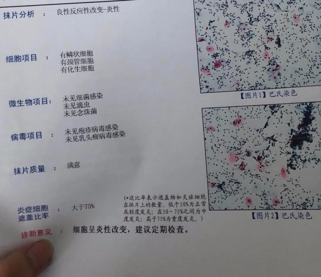 第一次去妇科检查需求注意什么,第一次产检妇科检查都有哪些项目