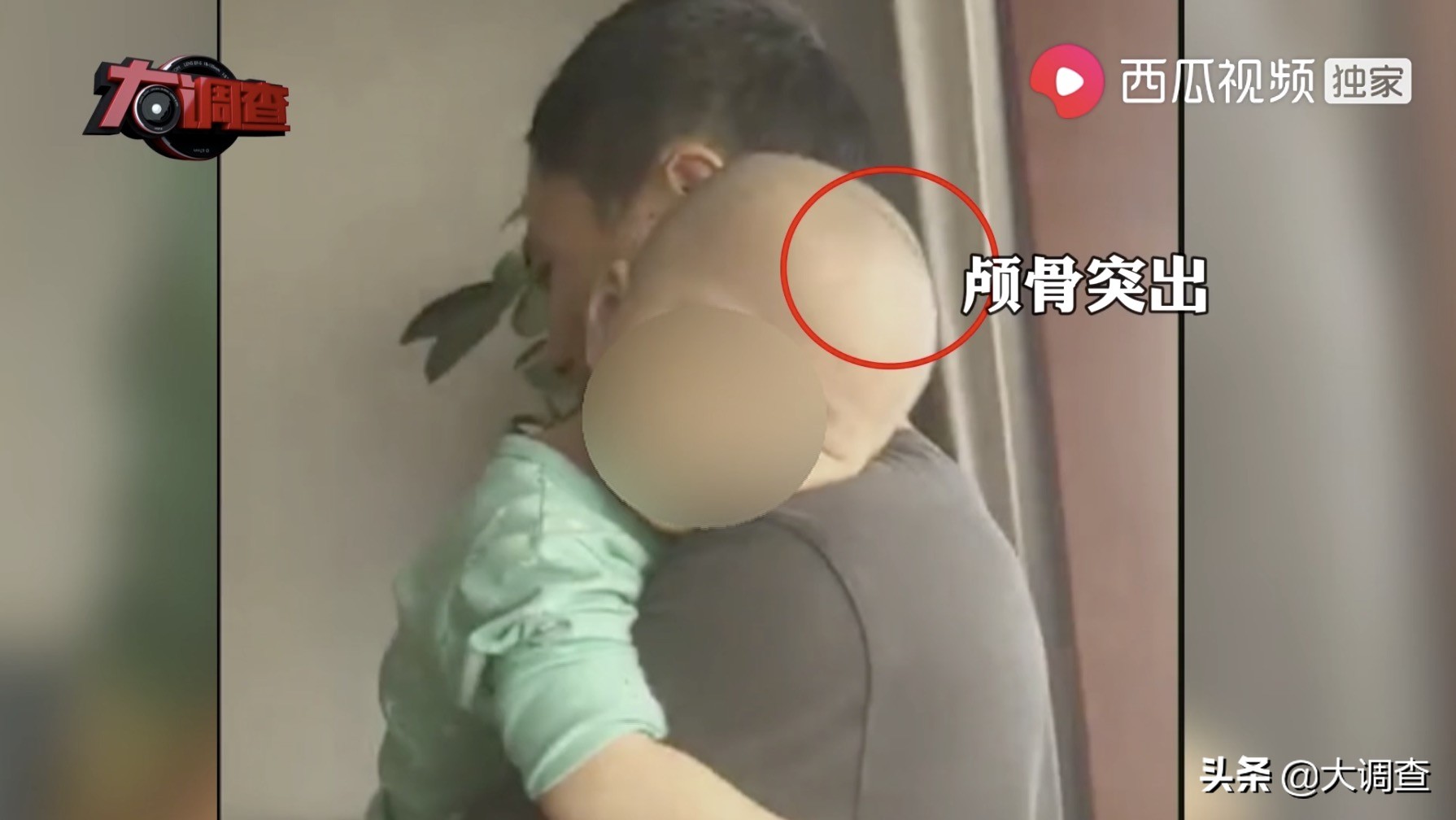 高度重视“大头娃娃”事件，当地政府成立调查专班：立即对涉事母婴店展开立案调查，对五个孩子全面体检