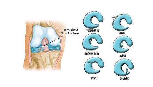 大叔摔倒,大叔跌倒