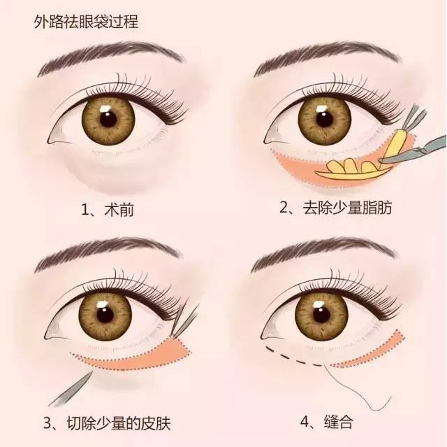 导致衰老的是哪个器官,导致衰老的原因